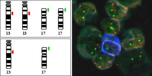 FISH-Technik zum Nachweis genetischer Veränderungen beim multiplen Myelom
